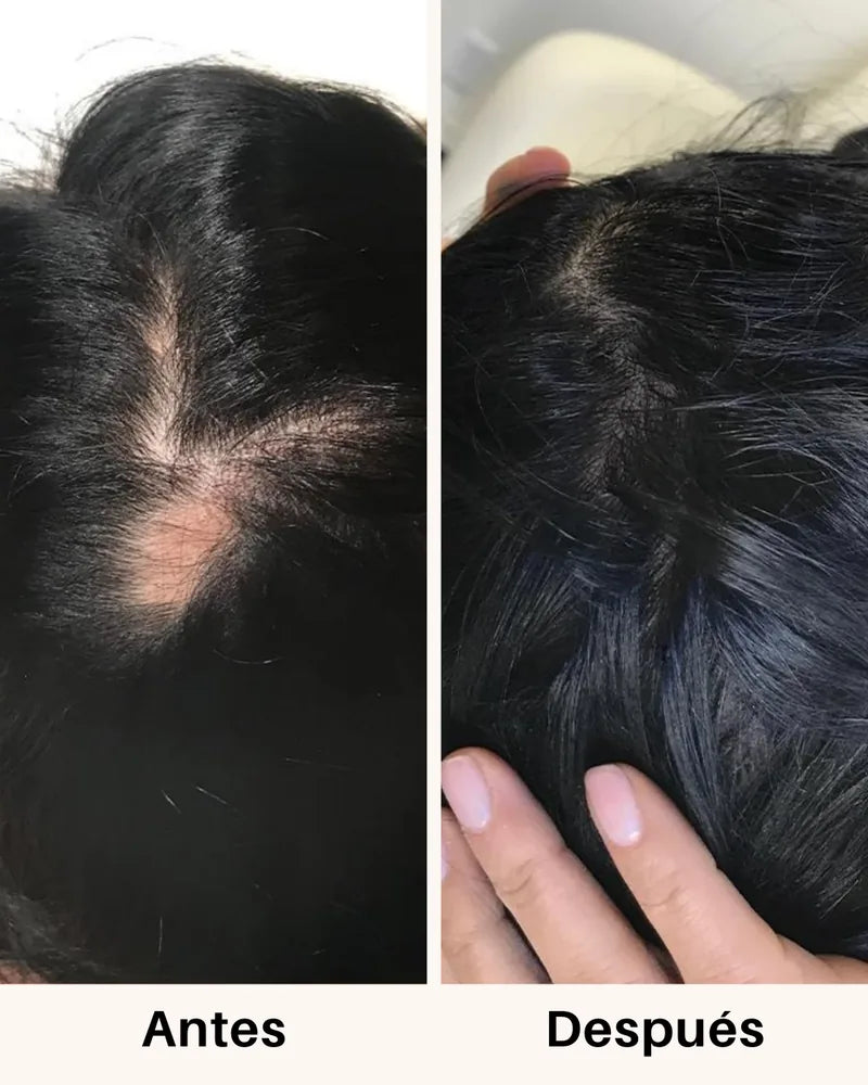 Cabello antes y después de tomar Fórmula Avanzada