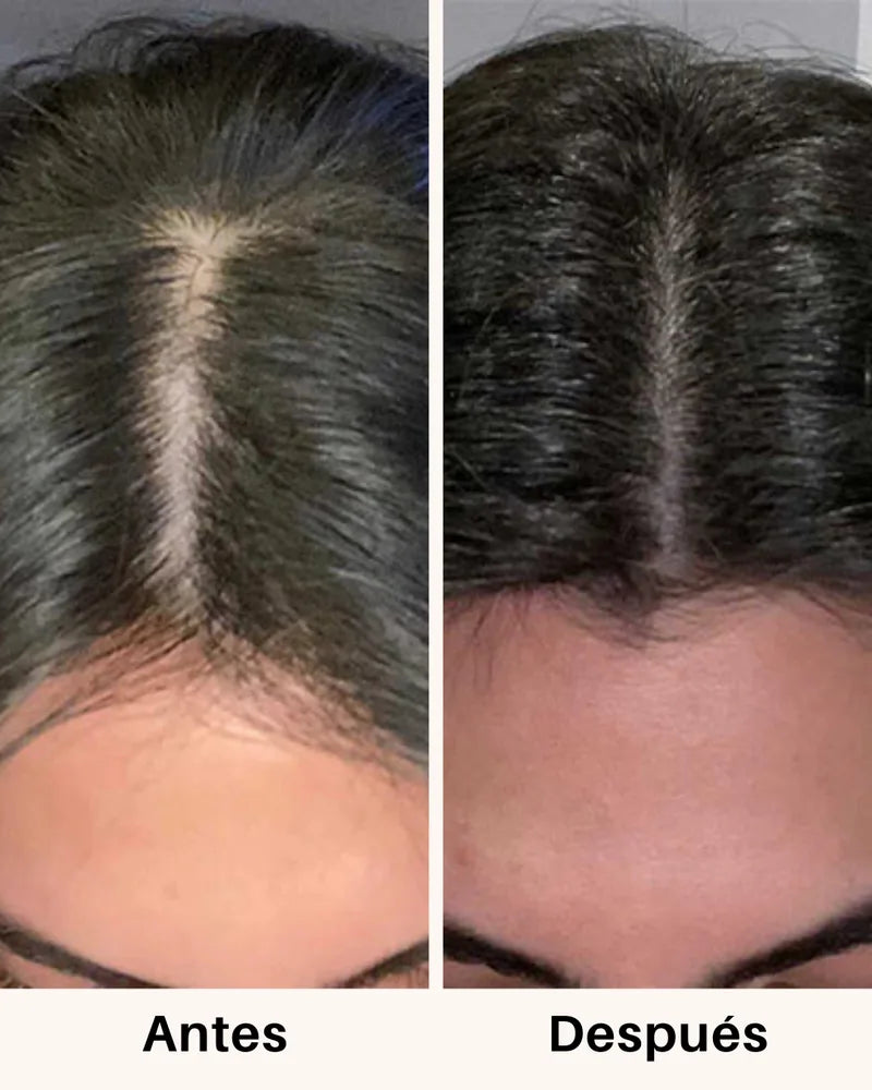 Cabello antes y después de tomar Fórmula Avanzada