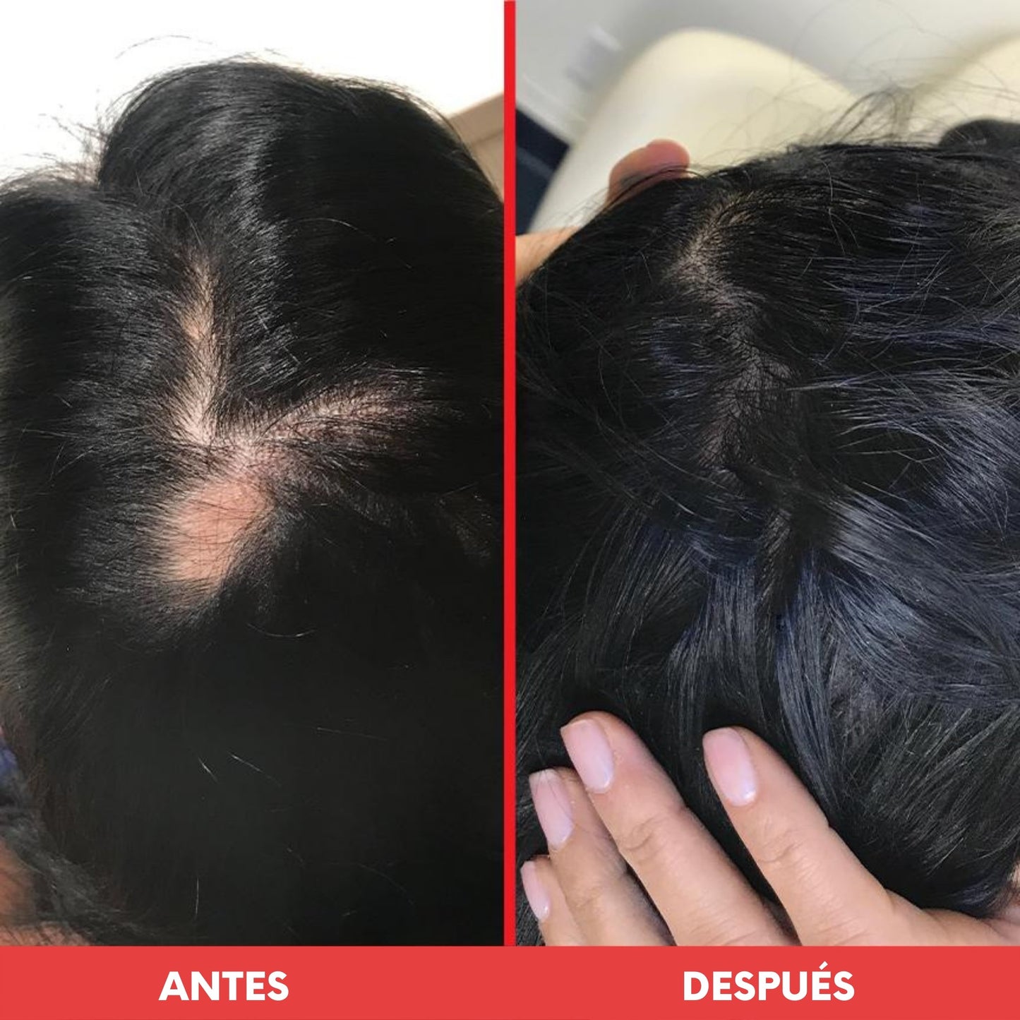 Bundle de Crecimiento 🔥HAIRtamin Fórmula Avanzada + Biotin Shampoo y Acondicionador - HairVitamins.mx