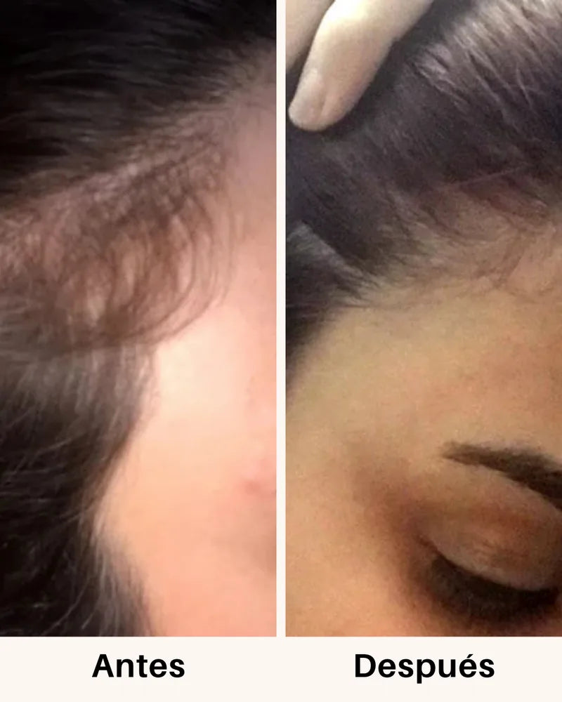 Cabello antes y después de tomar Fórmula Avanzada