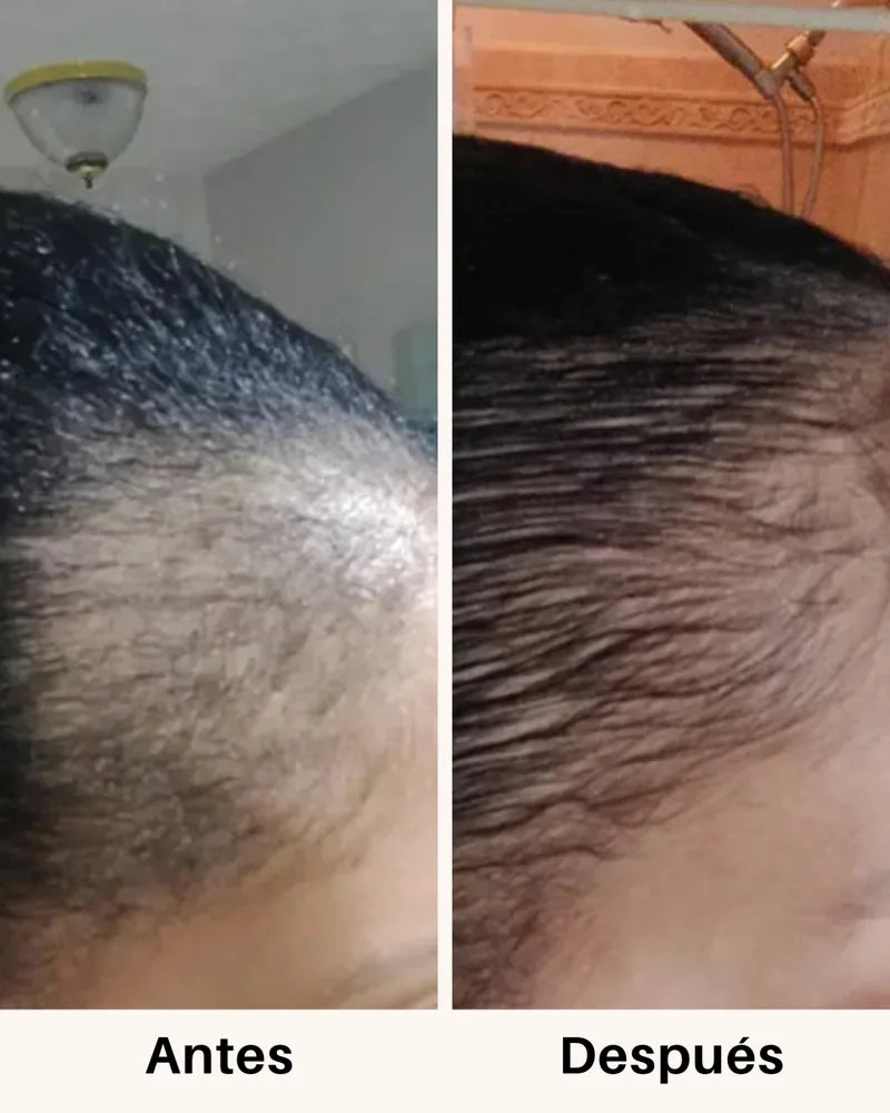 Cabello antes y después de tomar Fórmula Avanzada