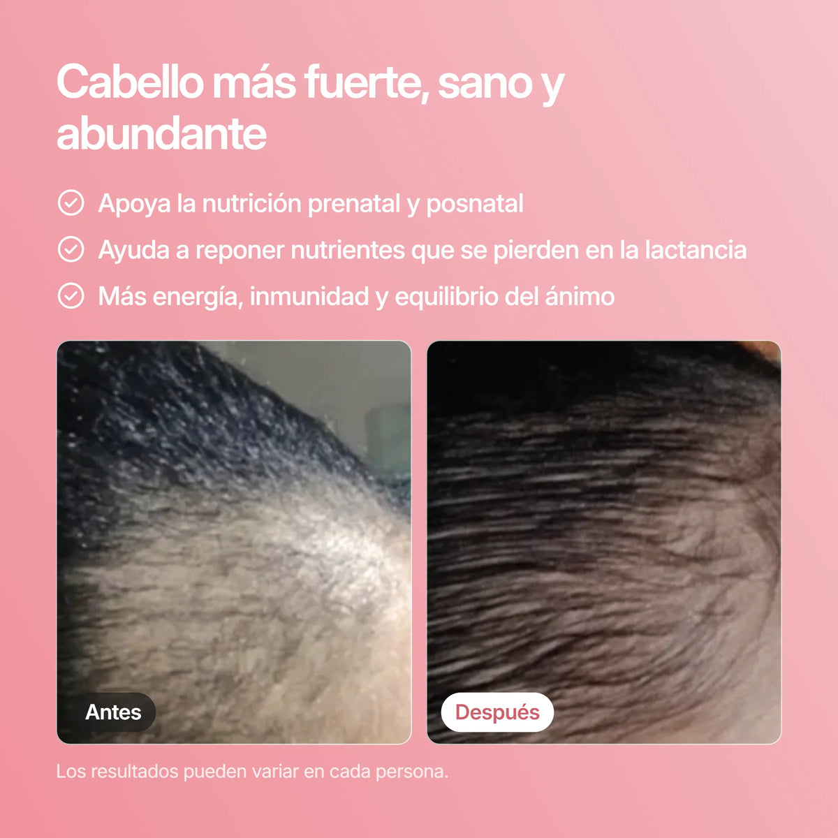 Bundle HAIRtamin Mom, resultados antes y después