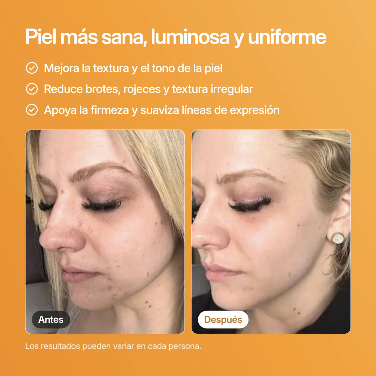 SKINtamin, resultados antes y después