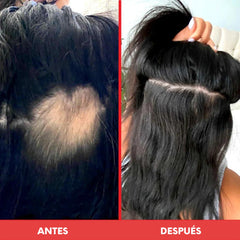 Bundle Hair Goals 🔥 HAIRtamin Fórmula Avanzada + Scalp Serum + Biotin Shampoo y Acondicionador - HairVitamins.mx