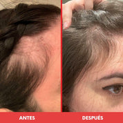 HAIRtamin Gummy Stars - HairVitamins.mx