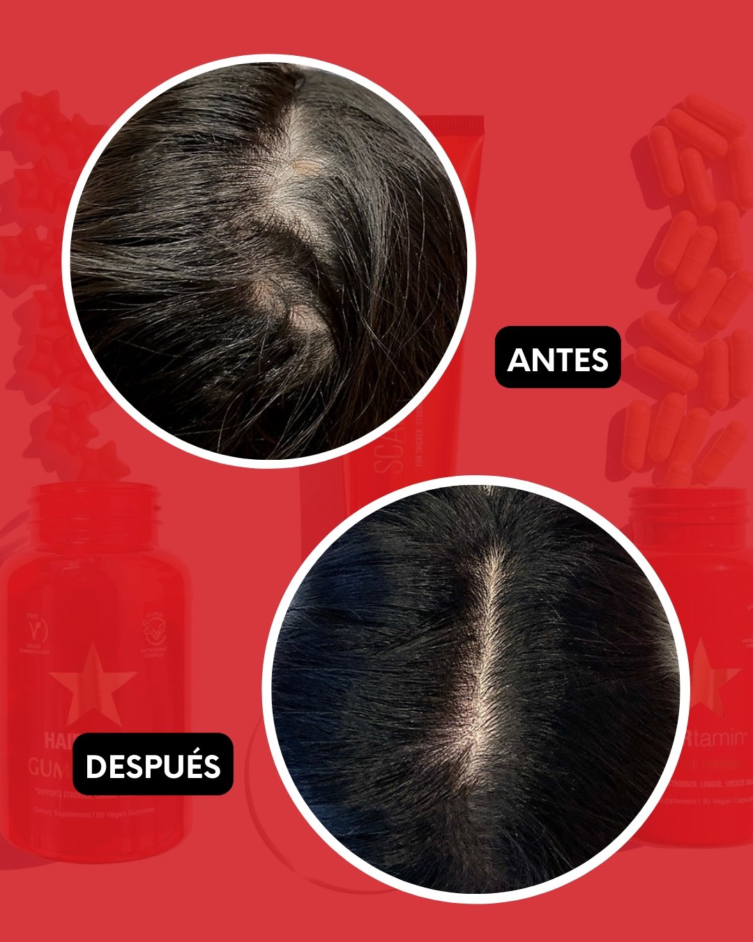 Scalp Serum - HairVitamins.mx